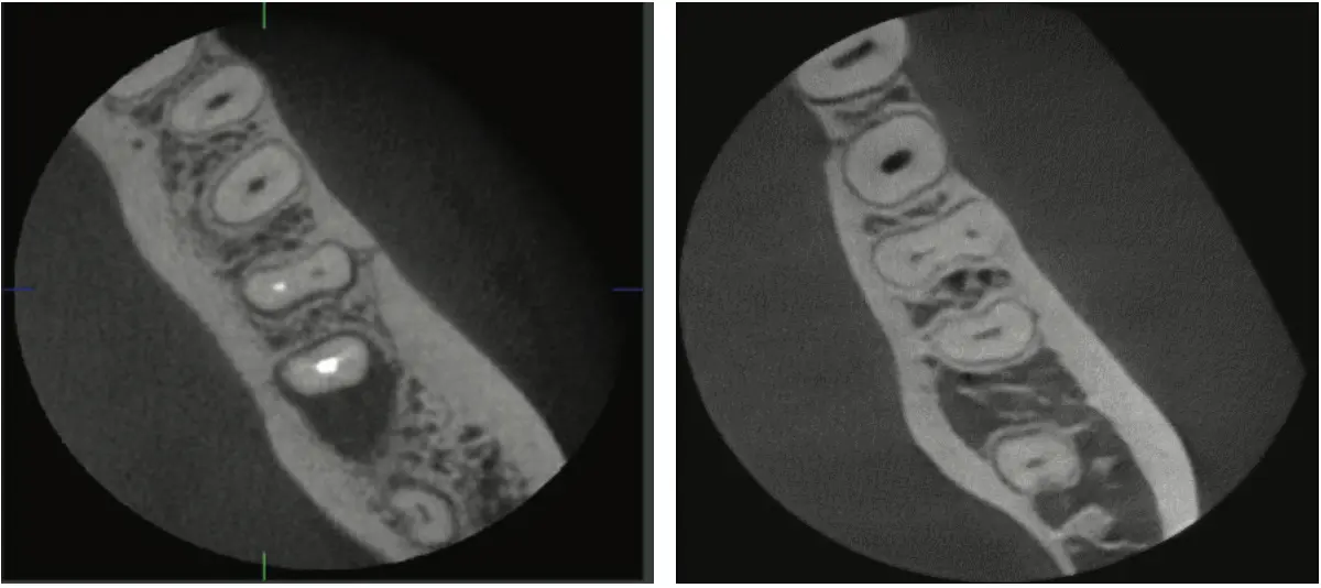 디지털보철솔루션 관련 이미지