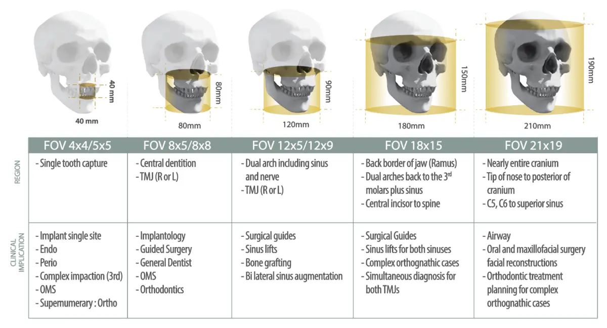 Vatech 관련 이미지