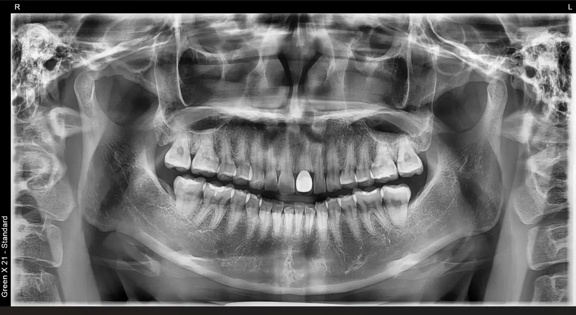 치과 의료기기 소모품 정품 공급