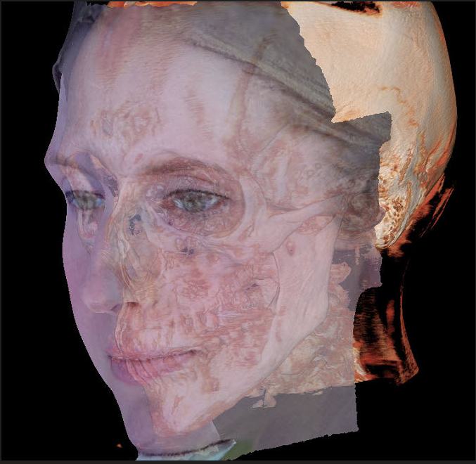 Face Scan 3D 안면 스캔 샘플